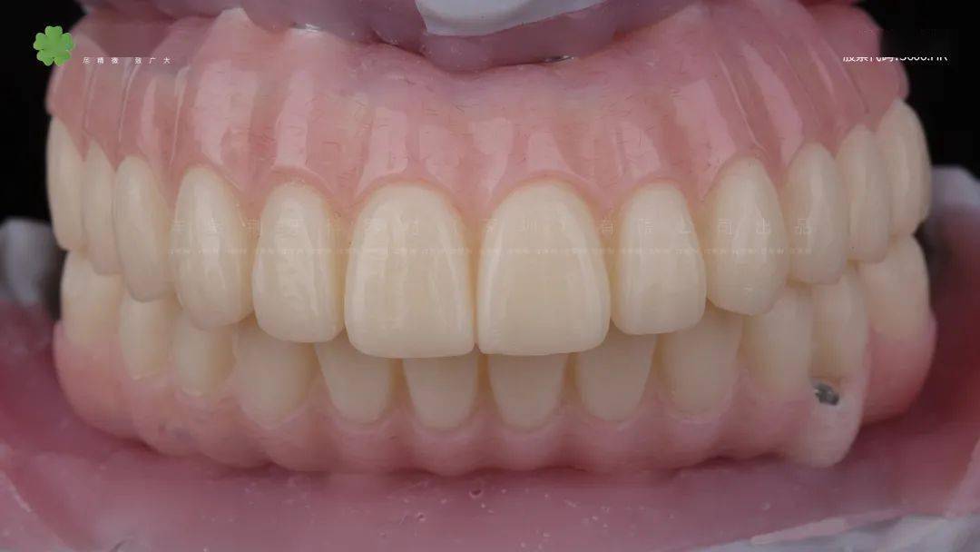 定期复查洋紫荆,是国内知名的牙科技工中心,成立于1998年.