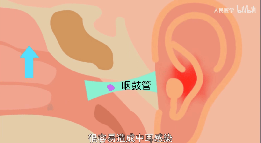 擤个鼻涕,咋还耳朵疼了?