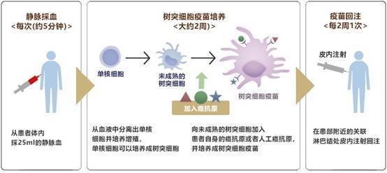 树突状细胞免疫疗法图片