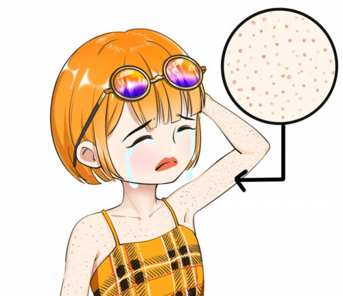 鱼鳞病鸡皮肤怎么治疗(鸡皮肤加鱼鳞病能治好吗)