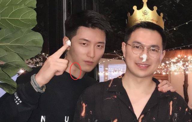 何超莲为闺蜜庆生,窦骁脖子上的"草莓"意外抢镜,其实是个误会_伤疤