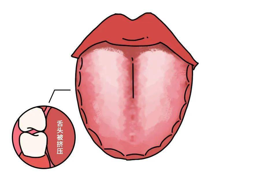 花边舌头图片