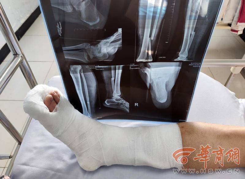 西安永泰路这处路面突然抬高 市民骑摩托车摔倒骨折_先生_道路_受伤