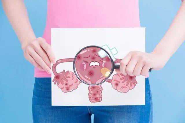 子宫肌瘤又称子宫平滑肌瘤,是女性生殖器最常见的一种良性肿瘤.