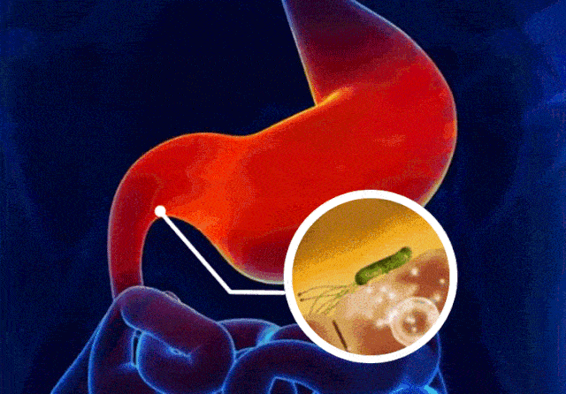 640_446gif 动态图 动图