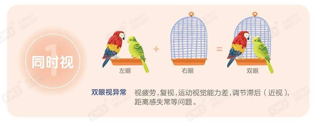 一级视功能:同时视双眼视功能可分为三级:同时视,融合视,立体视.