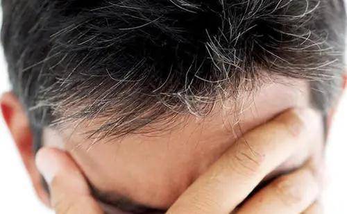 如今白发已不是老年人的专属了,很多年轻人也开始冒白发,这是为什么呢