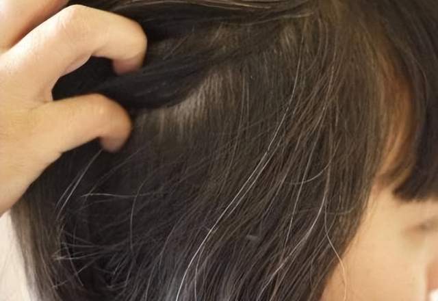 我的头发到底出了什么问题?_时候_经历_影响