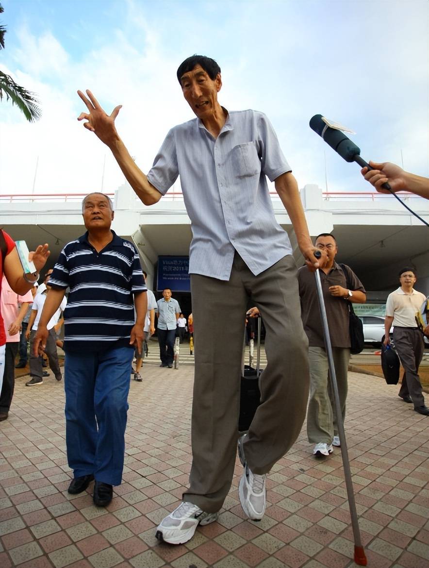 一个娇小玲珑,虽异于常人,但一样活出了精彩_鲍喜顺_身体_巨人