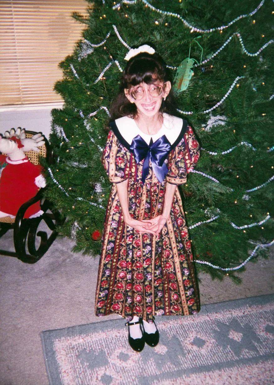 她是"世界上最丑的女人",17岁一丑成名,一天吃60