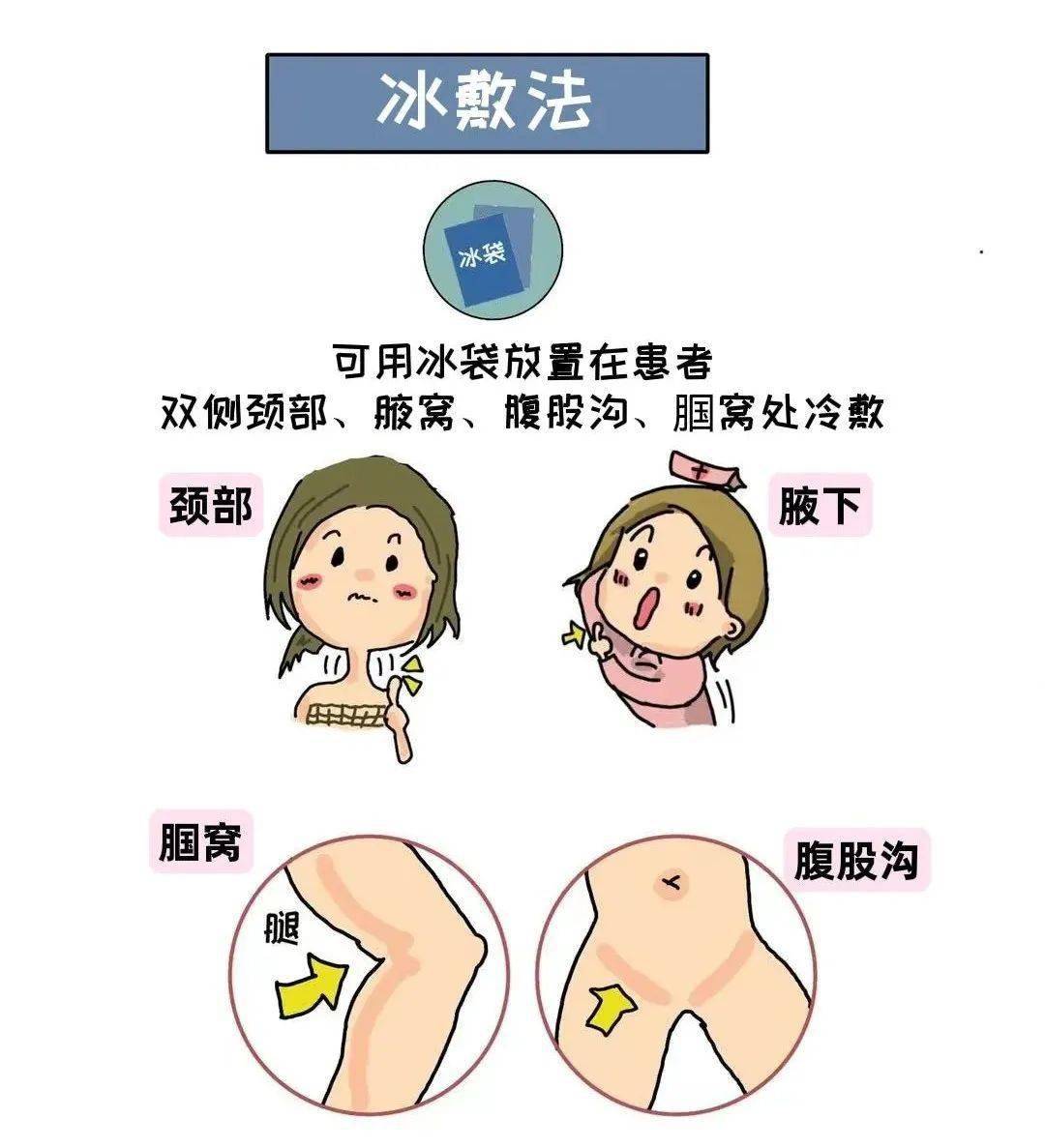 物理降温的位置图片图片