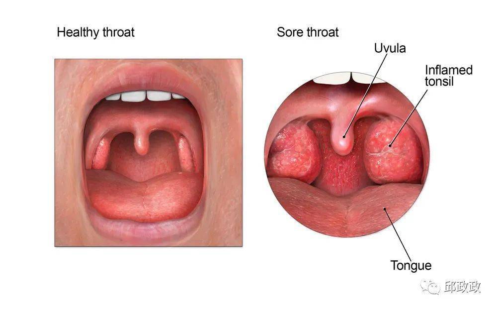 throat怎么读图片