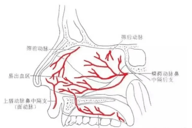健康科普 | "医生,我鼻子出血啦"_鼻腔_鼻中隔_患者