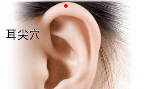 耳尖放血:耳尖穴位于耳廓上方,当折耳向前,耳廓上方的尖端处,耳尖放血