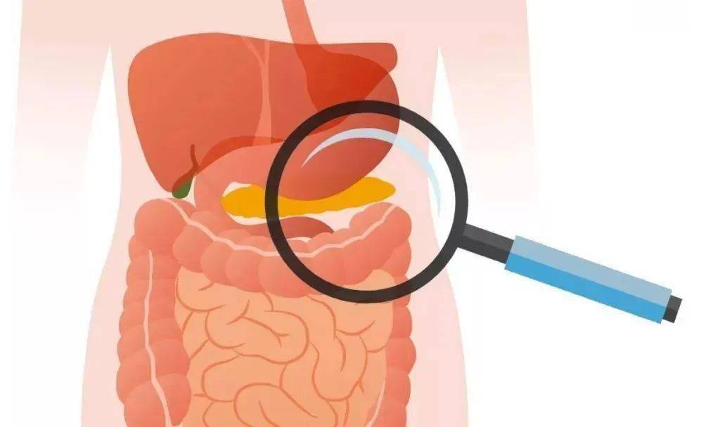 什么是胰腺外分泌功能不全?