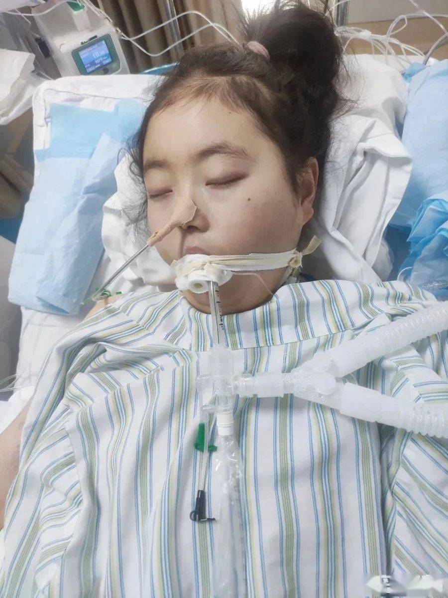 青岛花季少女患系统性红斑狼疮,盼好心人伸出援手_韩佳惠_治疗_妹妹