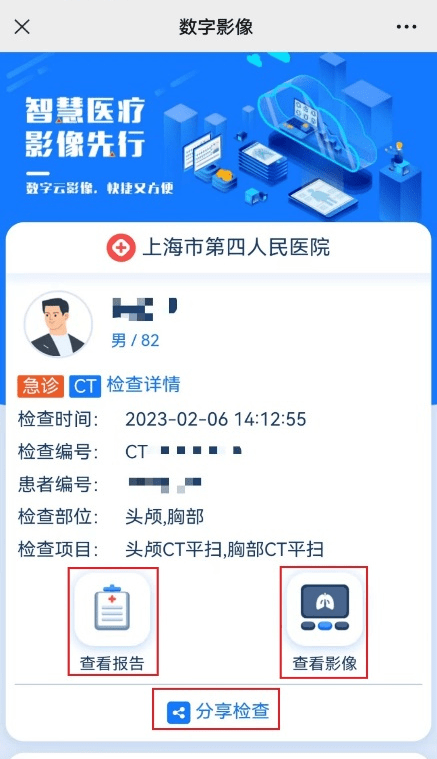 “云影像”来了！CT陈述手机上就能看……