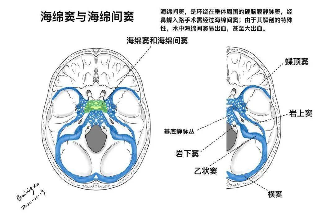 头颅静脉窦解剖图图片