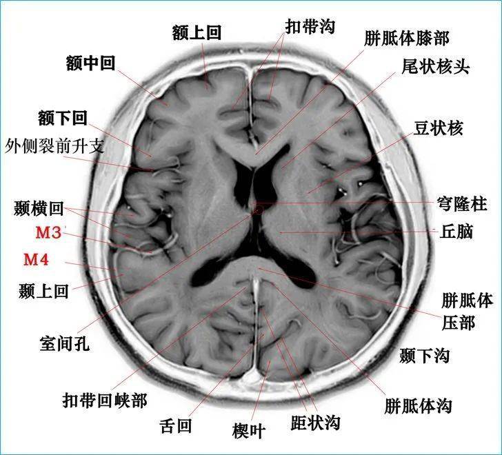 头颅海马的解剖结构图图片