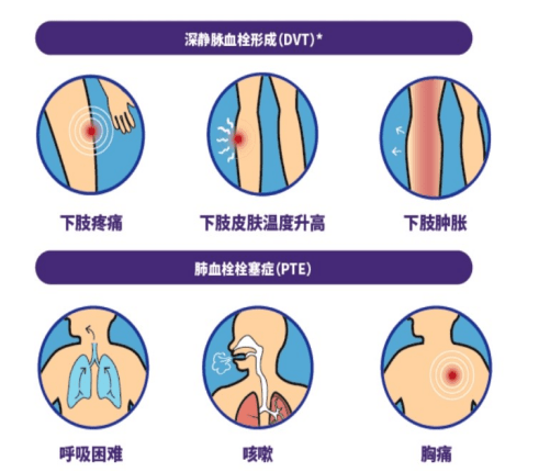 "沉默"的杀手——静脉血栓栓塞症(vte)_下肢_治疗_抗凝