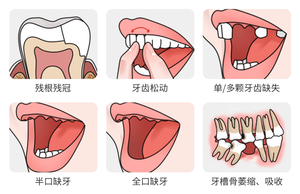 不限户籍，广东那项全民安康方案开启！！！