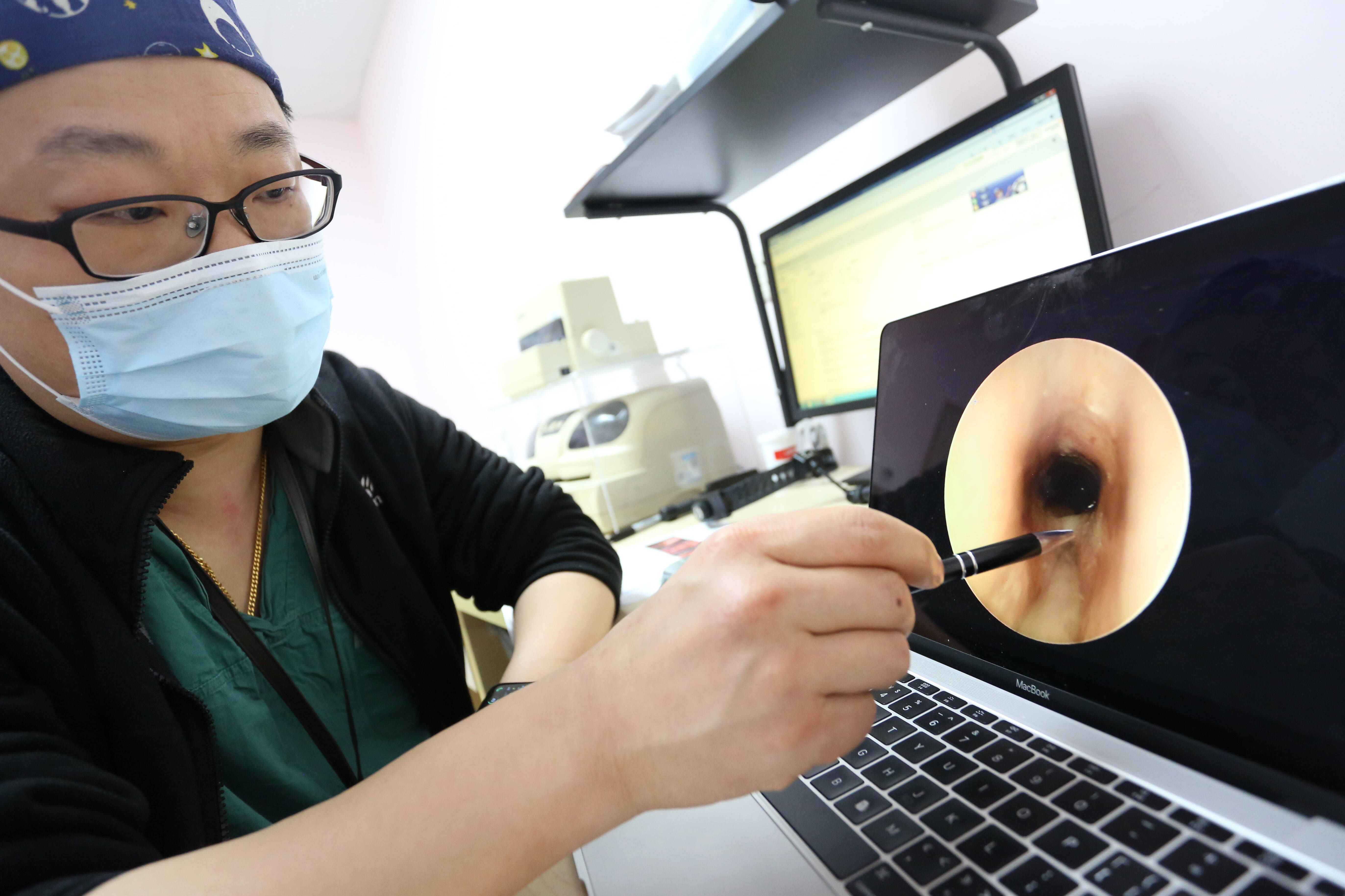 上海医生6小时成功救治一重度喉裂1岁幼儿 - 社会 - 优盟同城