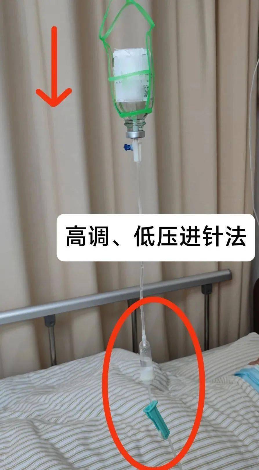 调节器高调,输液瓶低位法:2.