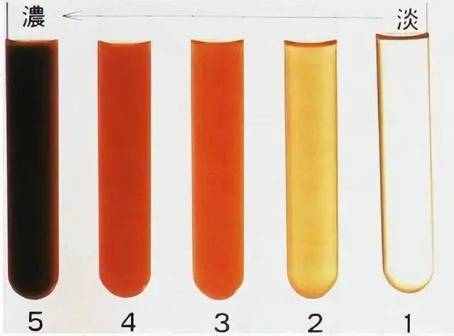尿液_肾脏_尿量
