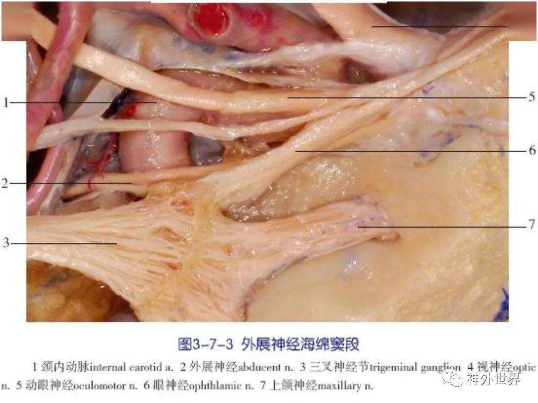 详细高清:海绵窦的解剖