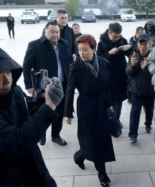 还秃了一块儿,但是一袭黑色风衣的杨澜,近日,移民国外的杨澜近况曝光