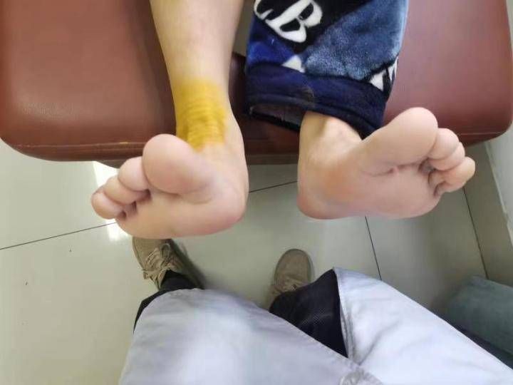 脚踝扭伤后,养养就能好是真的吗?是该热敷还是冰敷?