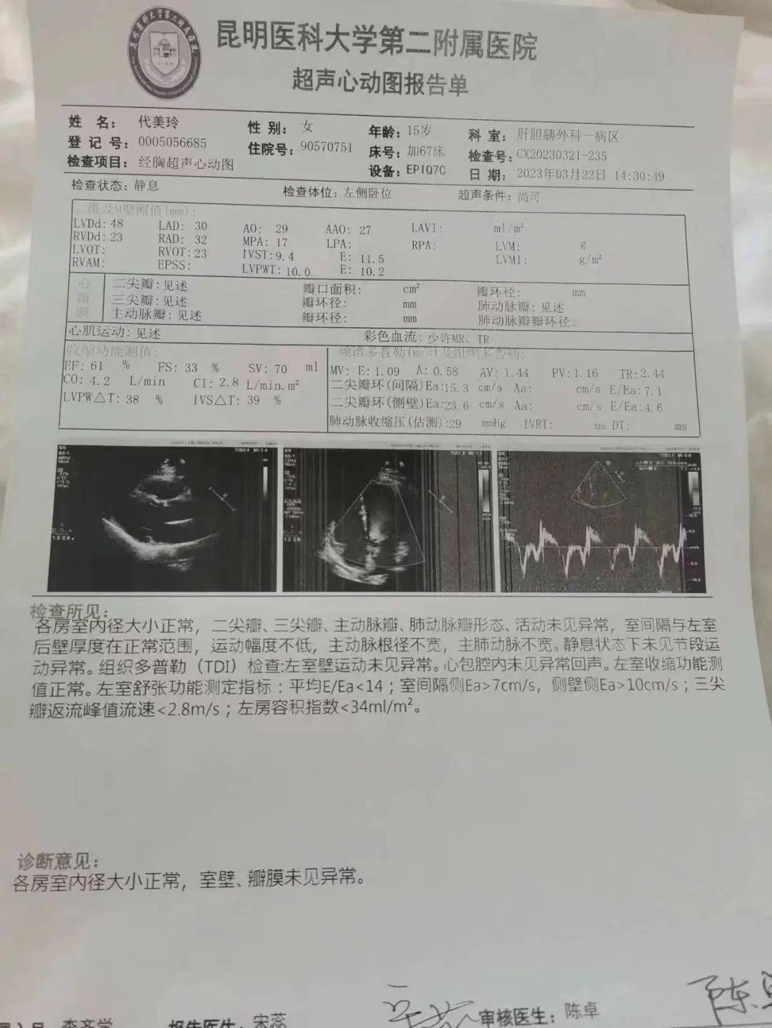 超声检查报告单图片图片