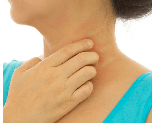 脖子先反馈,脖子有这3种信号,或可能是"癌细胞"想活跃_检查_颈部_癌症