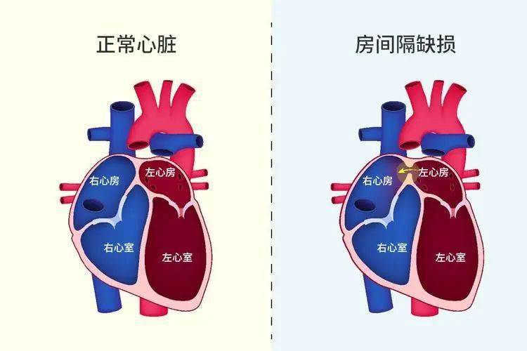 这一天他出门诊,来了对30多岁的夫妻,妻子第一次怀孕,23周,来咨询孩子