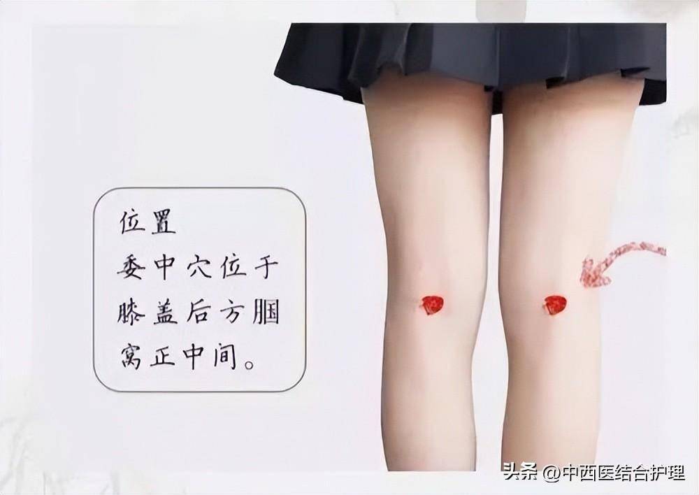 委中穴位于腿窝的中心点上,这里有个穴位叫委中穴,走的是膀胱经.