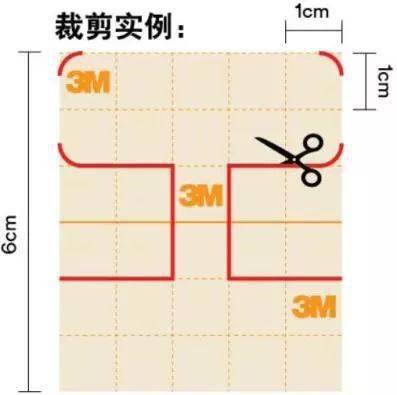 有图有真相:临床最实用的 3 种鼻胃管固定方法任你选_图片_胶带_案例