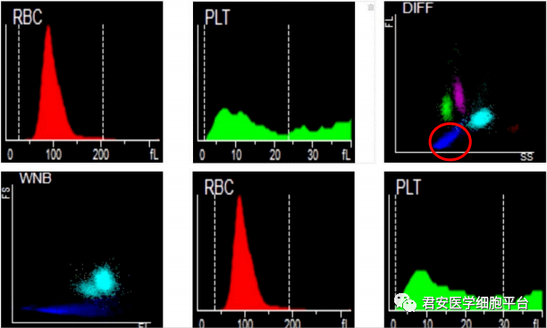 白细胞直方图怎么看图片