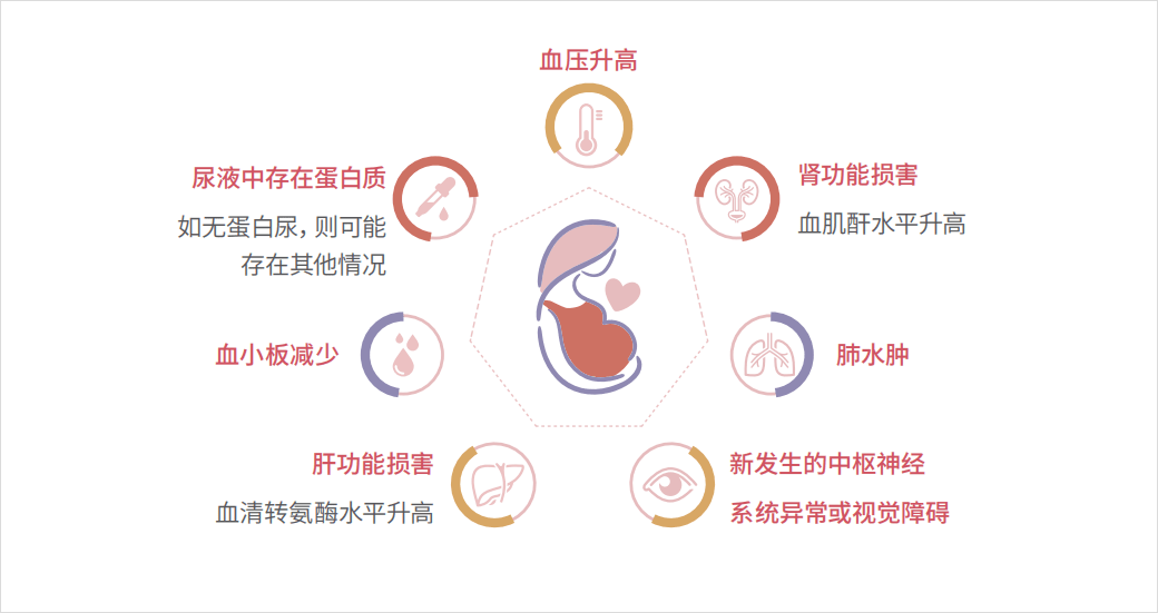 子痫前期您了解吗_孕妇_胎儿_进行