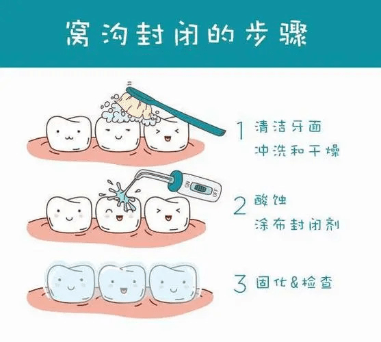 【健康科普】嘴里的痛楚——龋齿