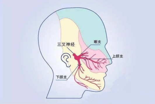 三叉神经影像解剖位置图片