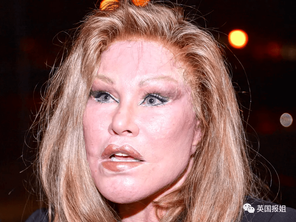 美国名媛为讨好富豪老公,狂砸千万整容成猫?