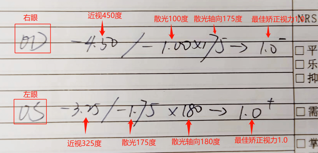 去眼科就诊,不管是配眼镜,还是看其他眼部毛病,很多时候都需要验光查