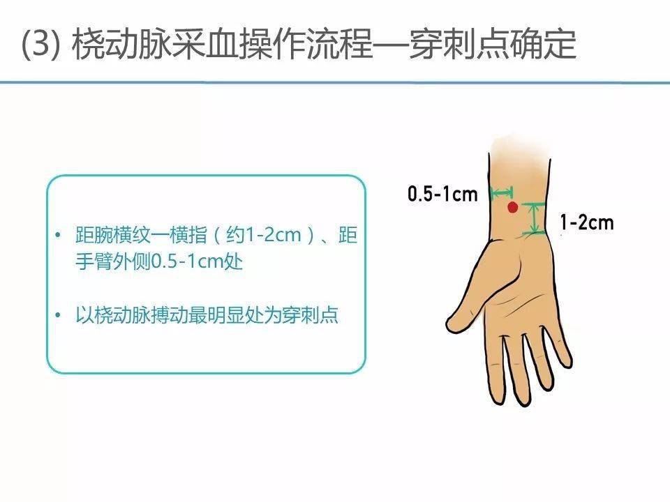 【ppt】动脉采血临床操作指南