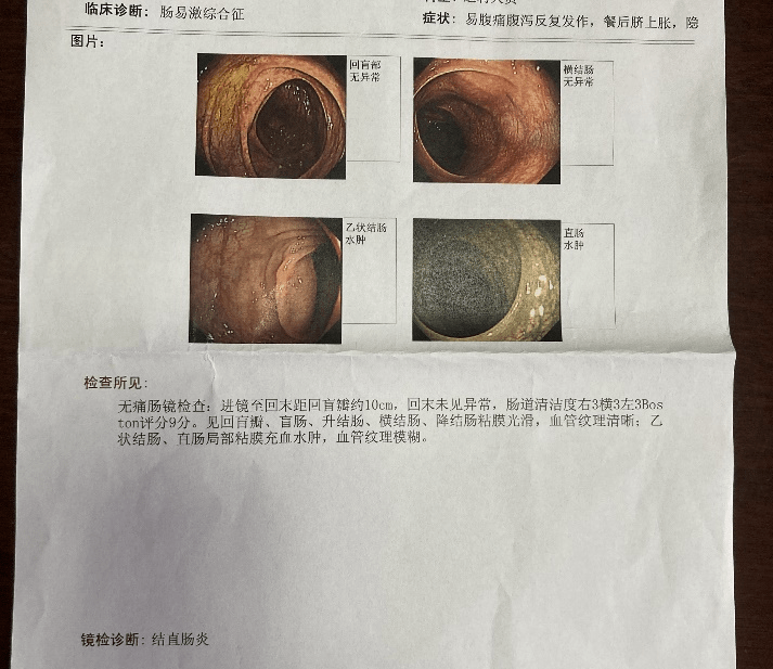 肠镜检查报告.