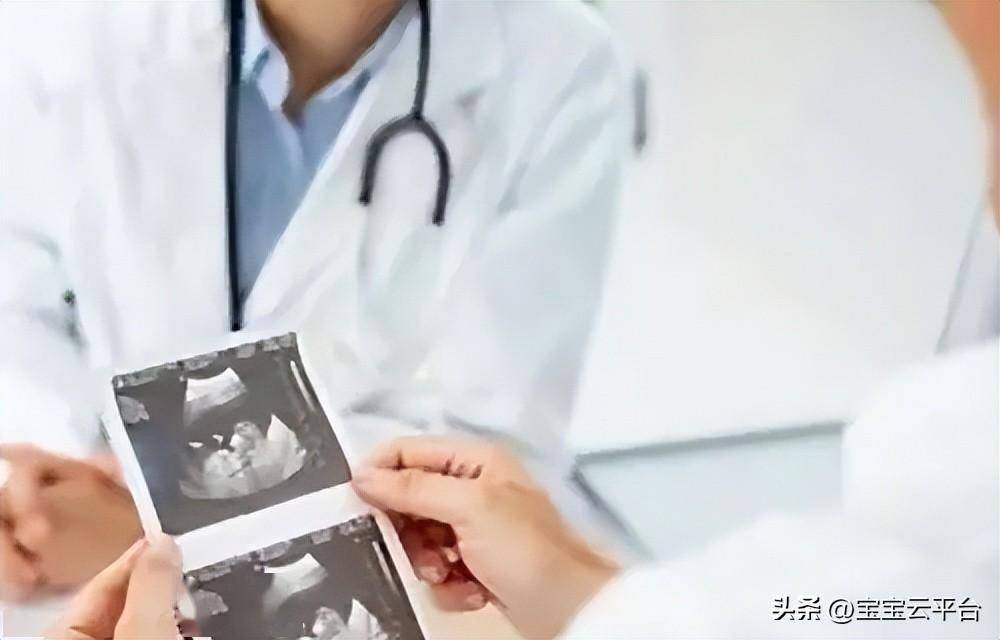 宫外孕检查单图片图片