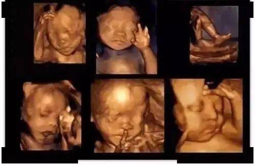 怀孕84天胎儿图片图片
