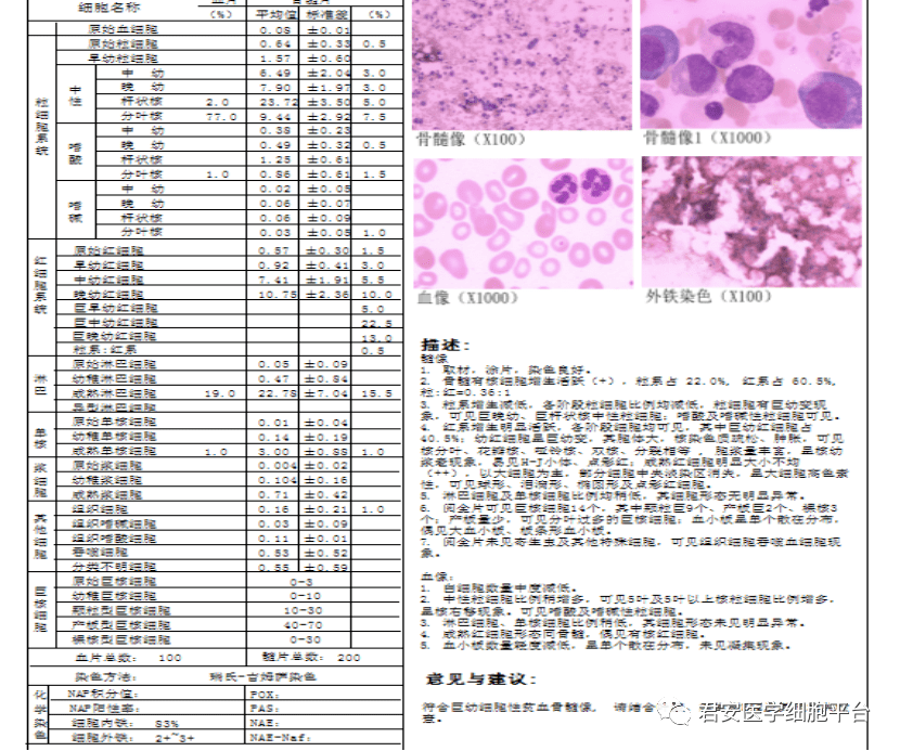 骨髓涂片报告图片