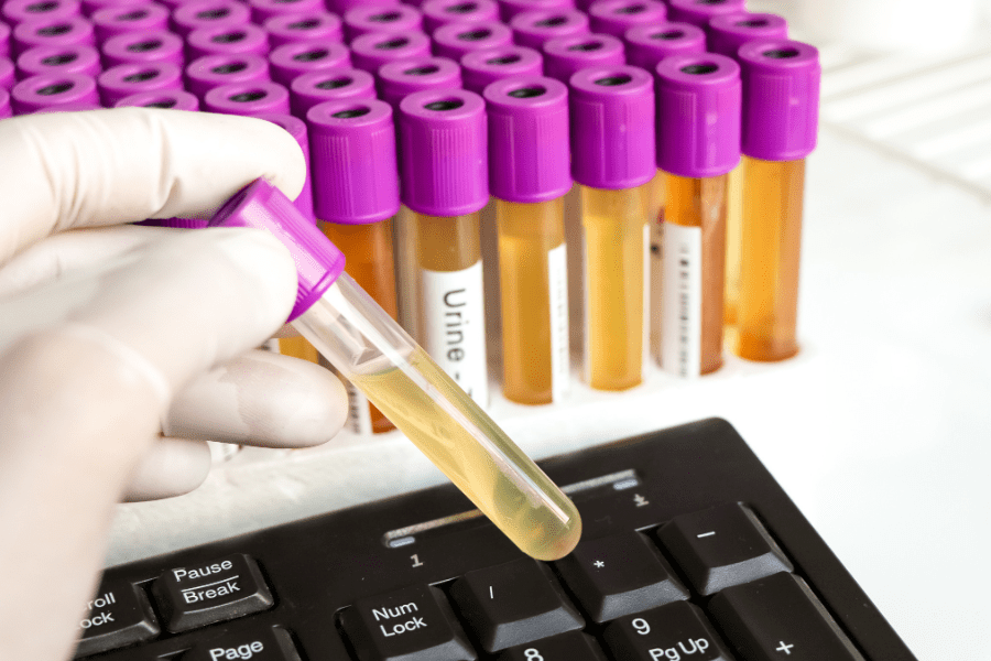 体检中,你的尿液标本留对了吗?常见的留尿误区不可不知!