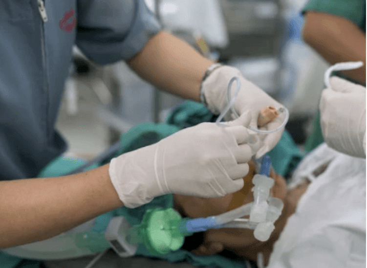 机械通气中喉罩和气管插管的pk,哪个会减少肺部并发症发生率?