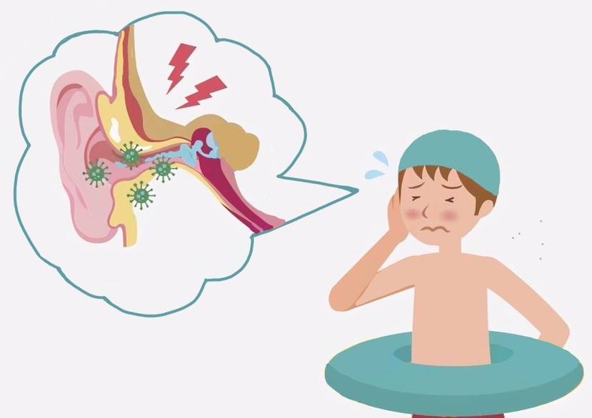 外耳道炎为夏季高发病,如何预防与科学护理?_皮肤_患者_耳朵